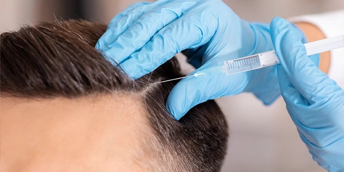 Dubai's PRP Hair Restoration: A Solution for Male and Female Hair Loss