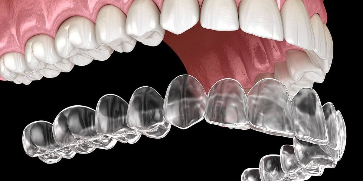 Clear Aligners Market is set for a Potential Growth Worldwide: Excellent Technology Trends with Business Analysis