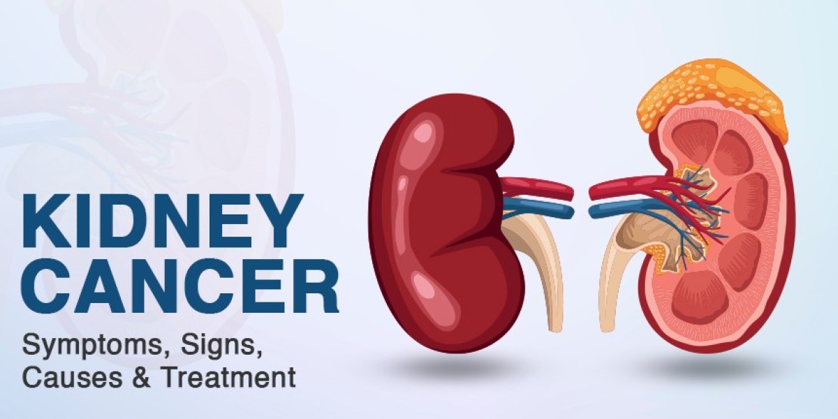 Kidney Cancer Treatments In Bangalore | Worldofurology