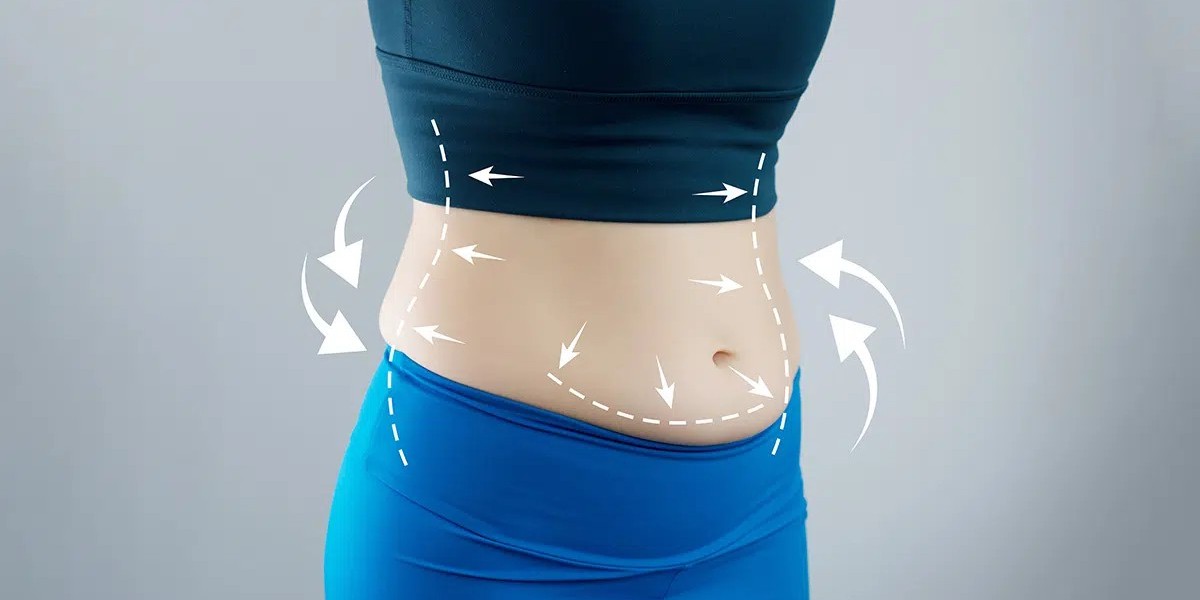 Liposuction Cost in Dubai Unlocks the Beauty of Sleek Contours
