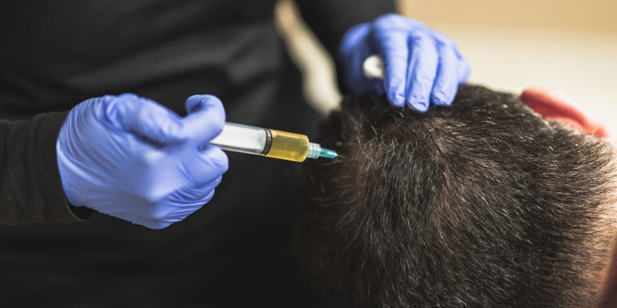 Does the Best PRP Hair Treatment Regrow Hair?