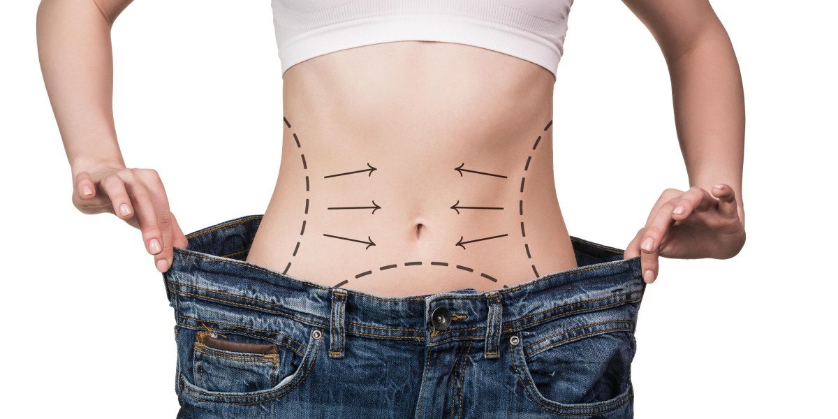Combining Liposuction with a Tummy Tuck in Islamabad