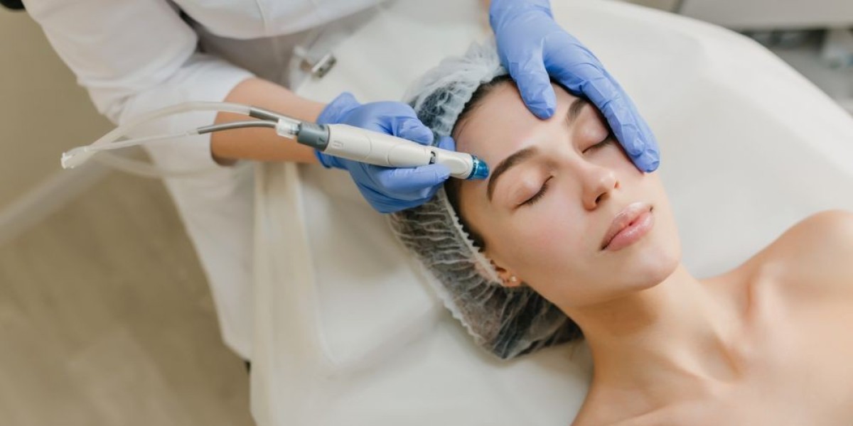 Top Benefits of Pico Laser Treatment for Pigmentation