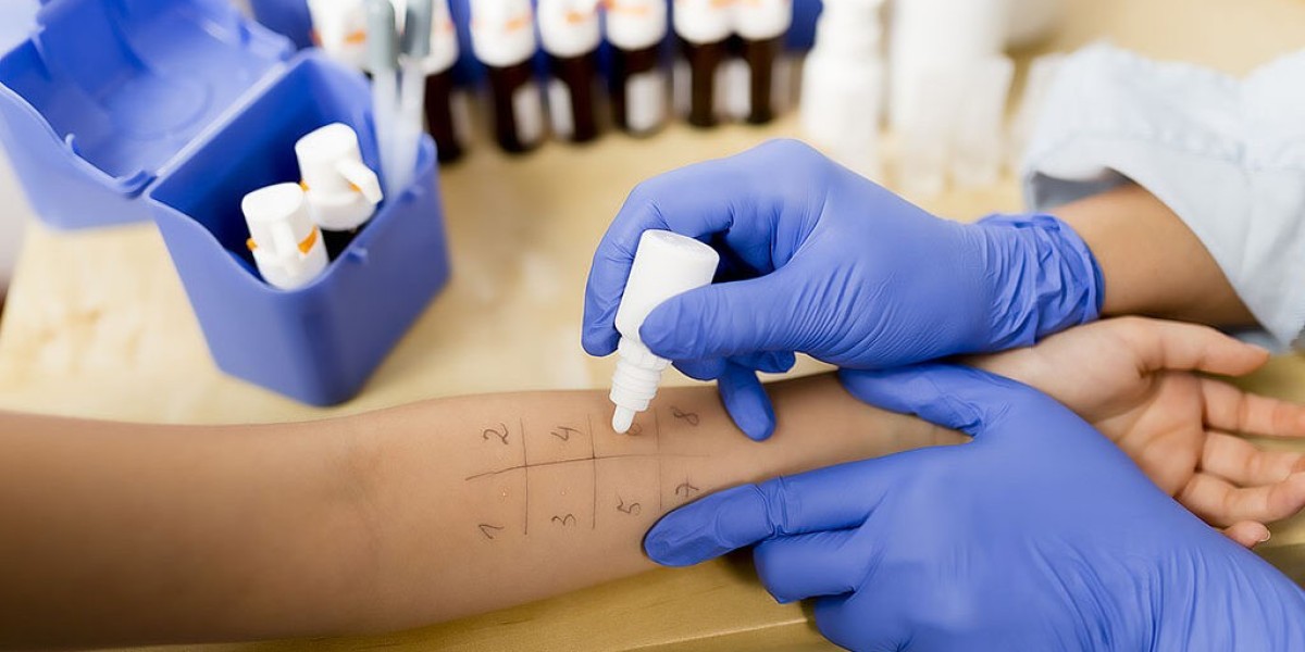 Scratch Testing Service in Fallon: Identify Allergies Quickly and Safely