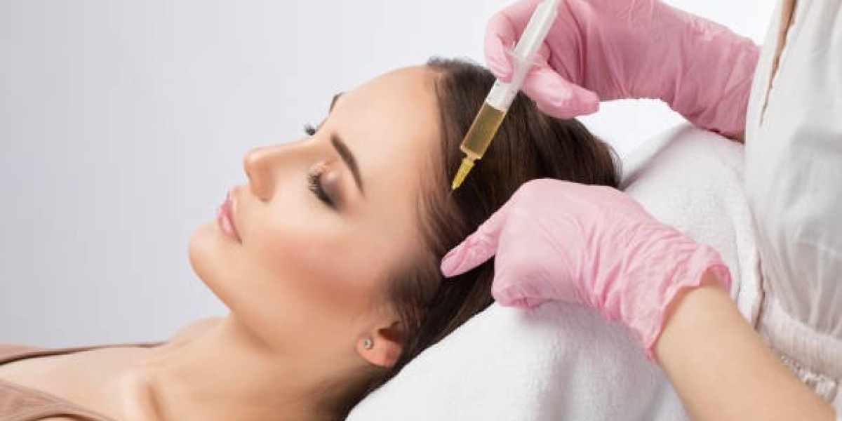 PRP Hair Treatment in Dubai: How Many Sessions Are Needed?