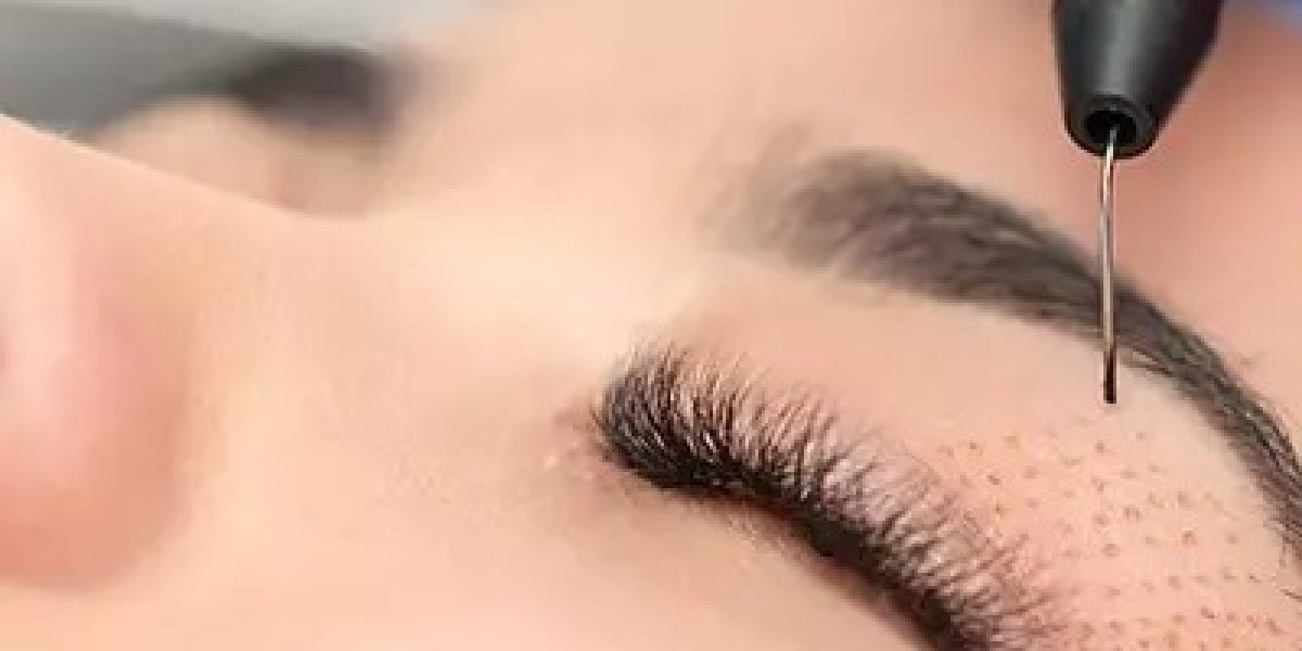 Inside Dubai’s Most Sought-After Eye Lift: What Really Happens During a Plexr Treatment?