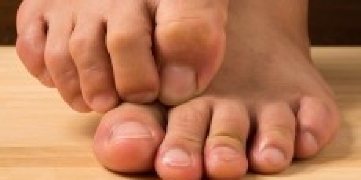 Effective Solutions for Treating Fungal Infections During the Monsoon Season