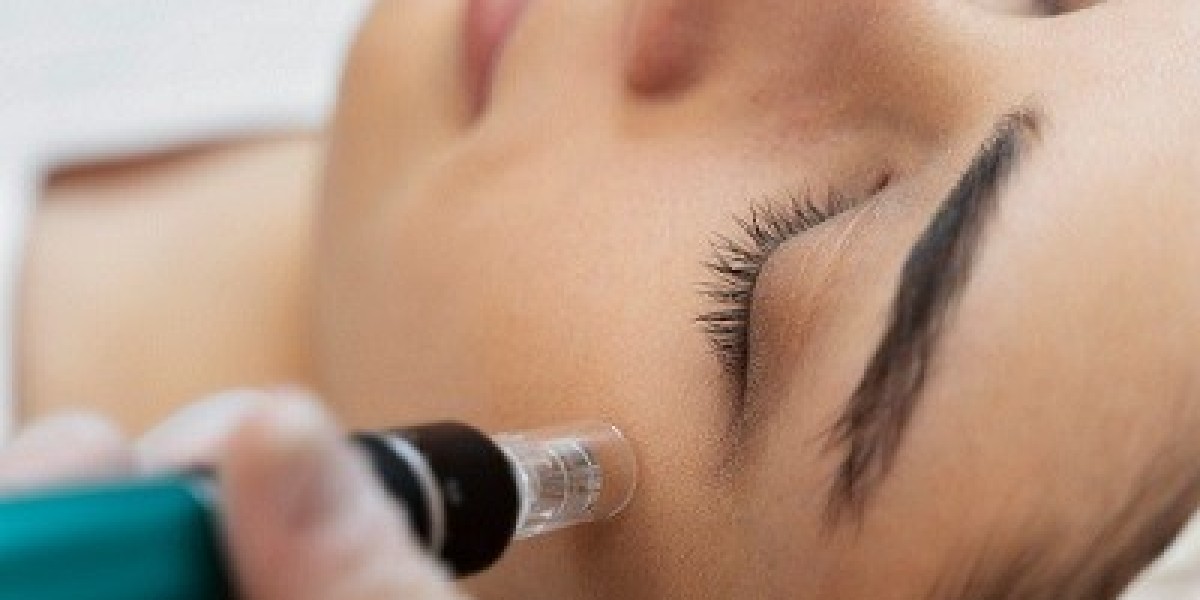 Can Dermapen Be Used on Dark Circles Under the Eyes?
