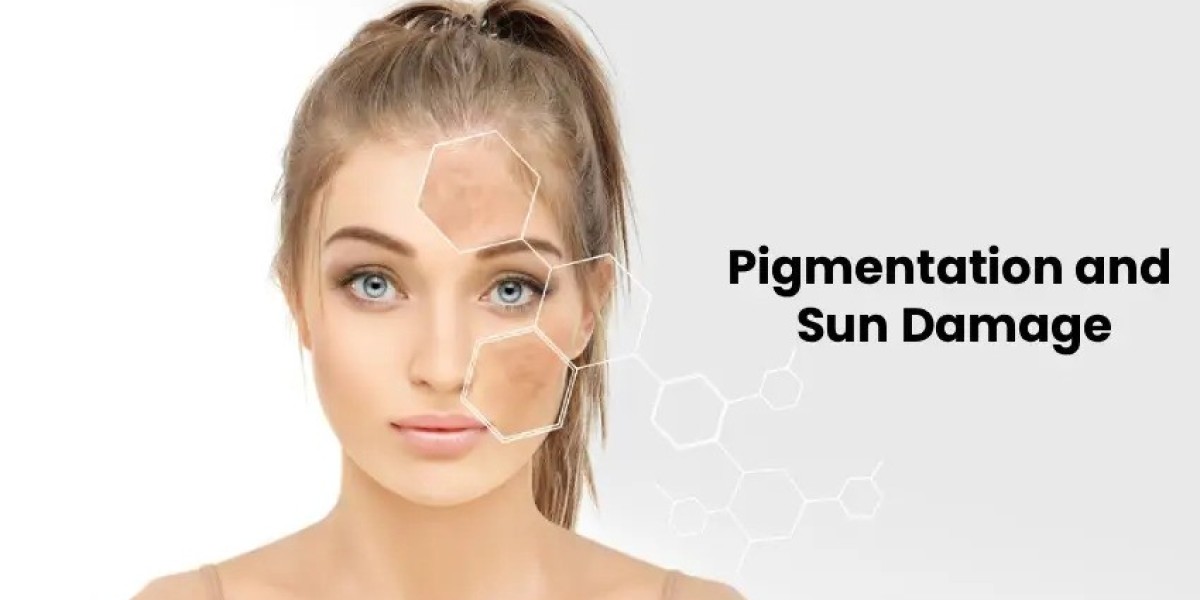 Pigmentation and Sun Damage Treatment: All You Need to Know