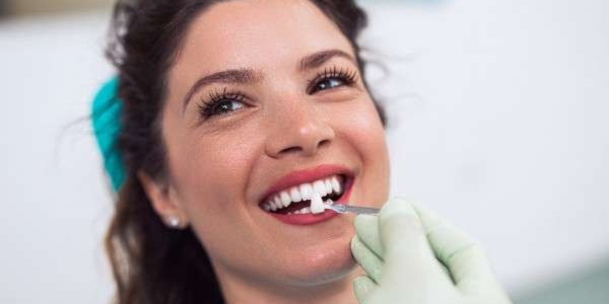 Hygienist vs. Dentist: Who Do You Need in Muswell Hill