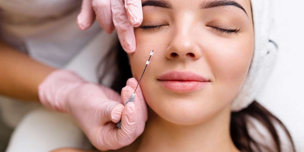 Top Benefits of Getting a Sugar Thread Lift