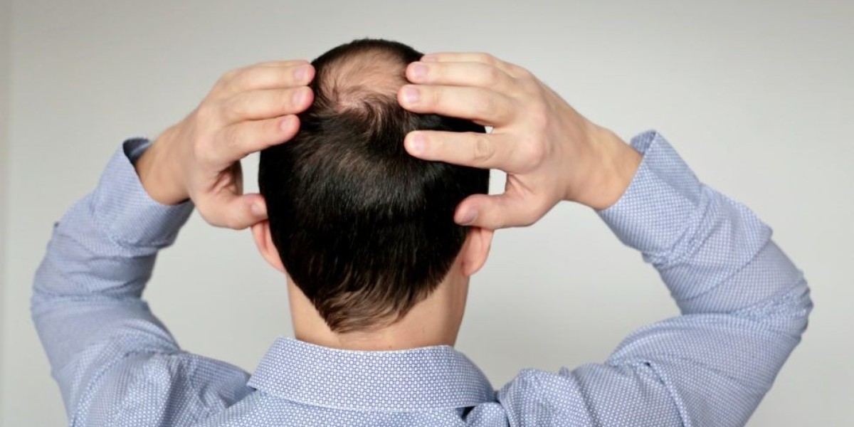 Hair Transplant Consultation Riyadh