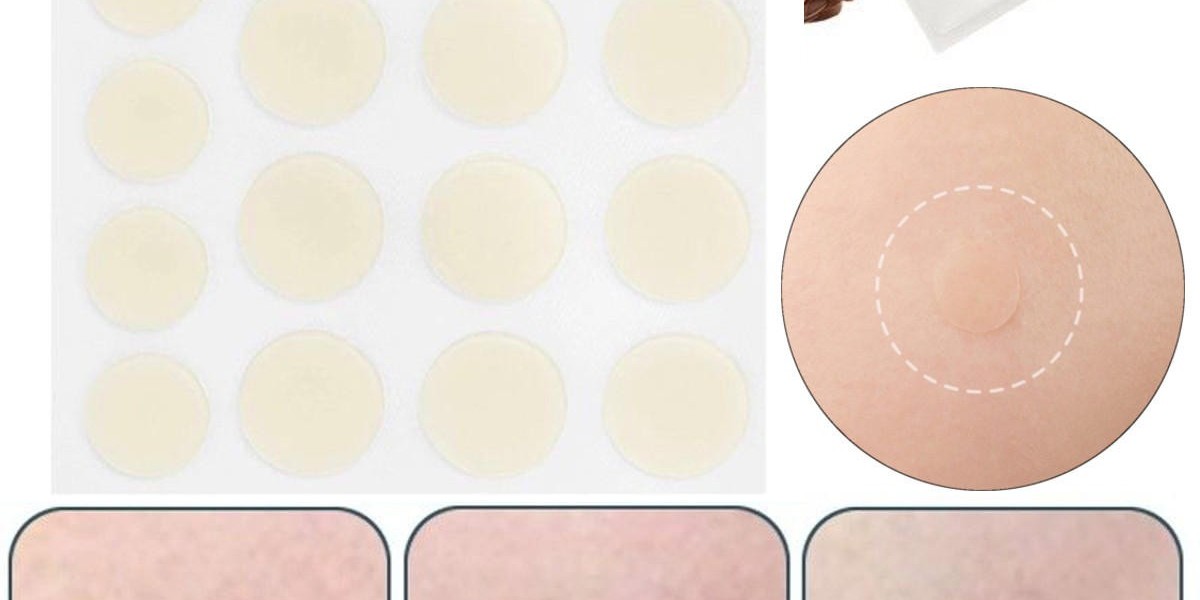 Global Anti-Acne Dermal Patch Market: Small Stickers, Big Impact