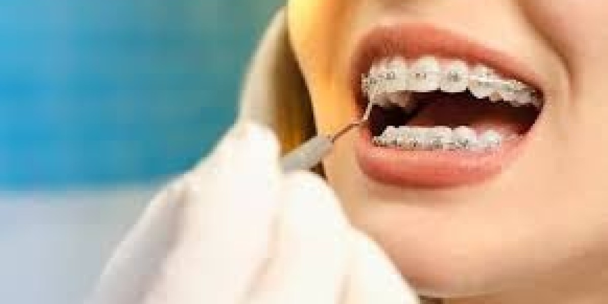 Orthodontic Retainers Market Expands with Surge in Cosmetic Dentistry and Oral Health Awareness