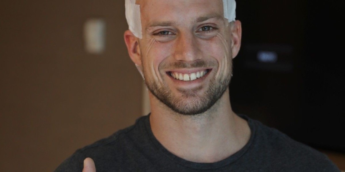 Hair Transplant in Dubai: Myths vs. Facts You Should Know Before the Procedure