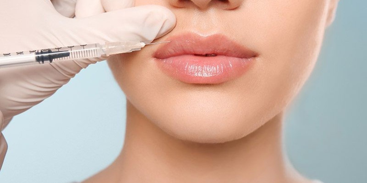 How Safe Are Lip Fillers Dubai