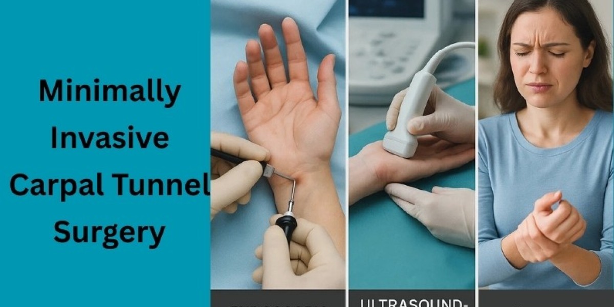 A Patient’s Guide to Minimally Invasive Carpal Tunnel Surgery Options