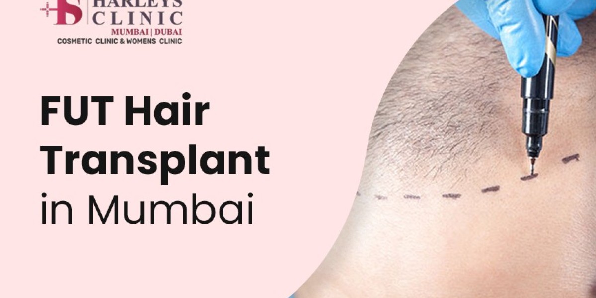 What Happens During FUT Hair Transplant?