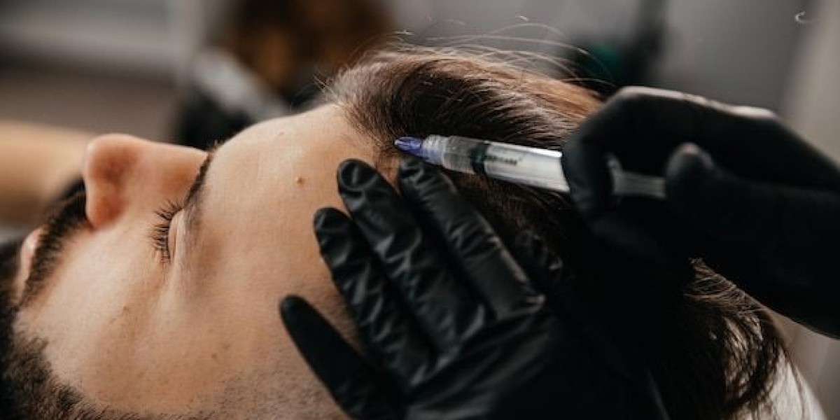 PRP Injection for Hair Riyadh