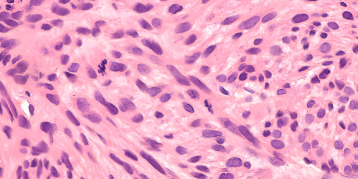 Exploring the Potential of Tumour Necrosis Factor Ligand Superfamily Member 15 Inhibitors