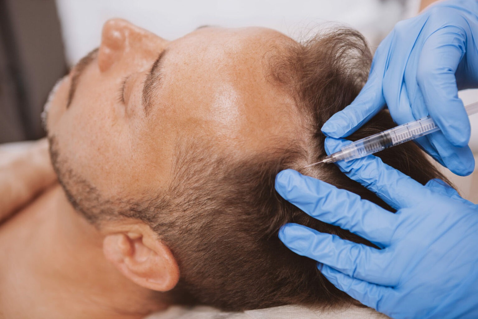 Front Line Hair Fixing