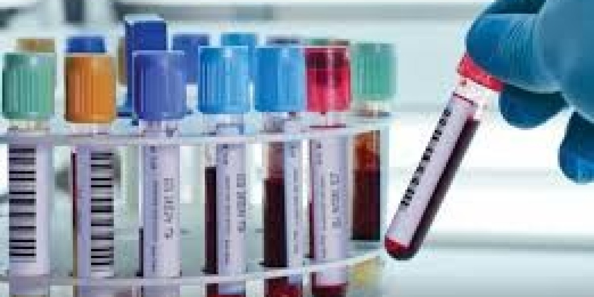 Blood Collection Tubes Market Overview Explains Role in Streamlining Healthcare Workflow Processes Globally