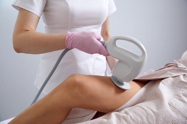 Laser Stretch Marks Treatment
