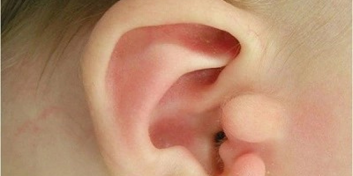Is It Safe to Perform Skin Tag Removal on Children?