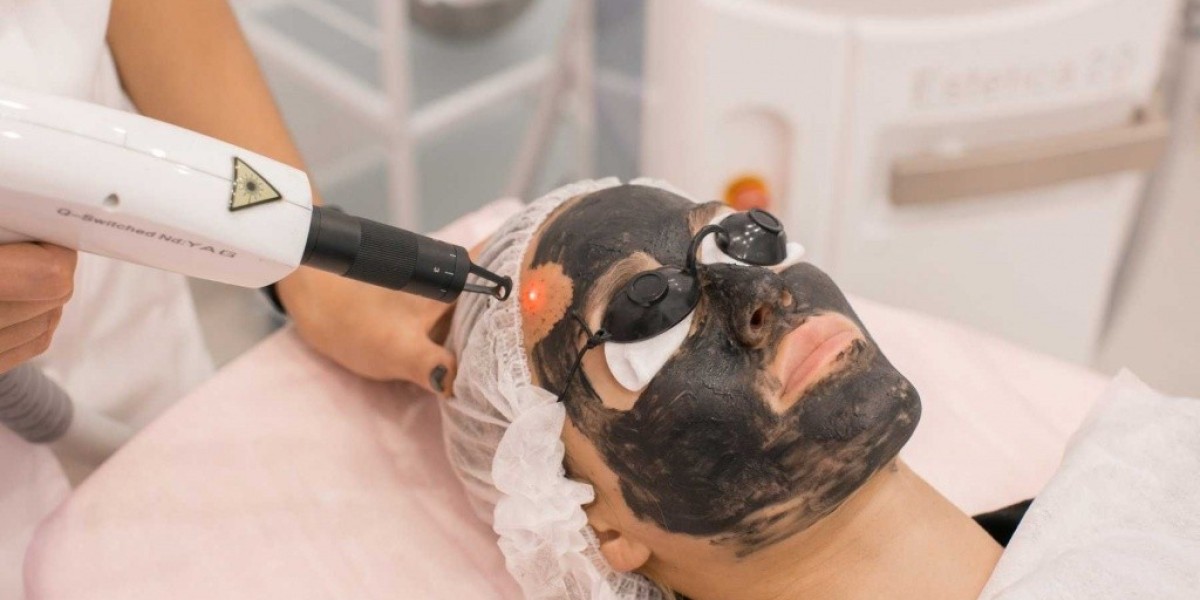 How long do the effects of Laser Hair Bleaching last?