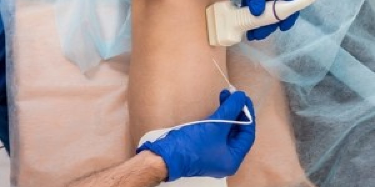 Aortic Aneurysms: Surgical Options Explained