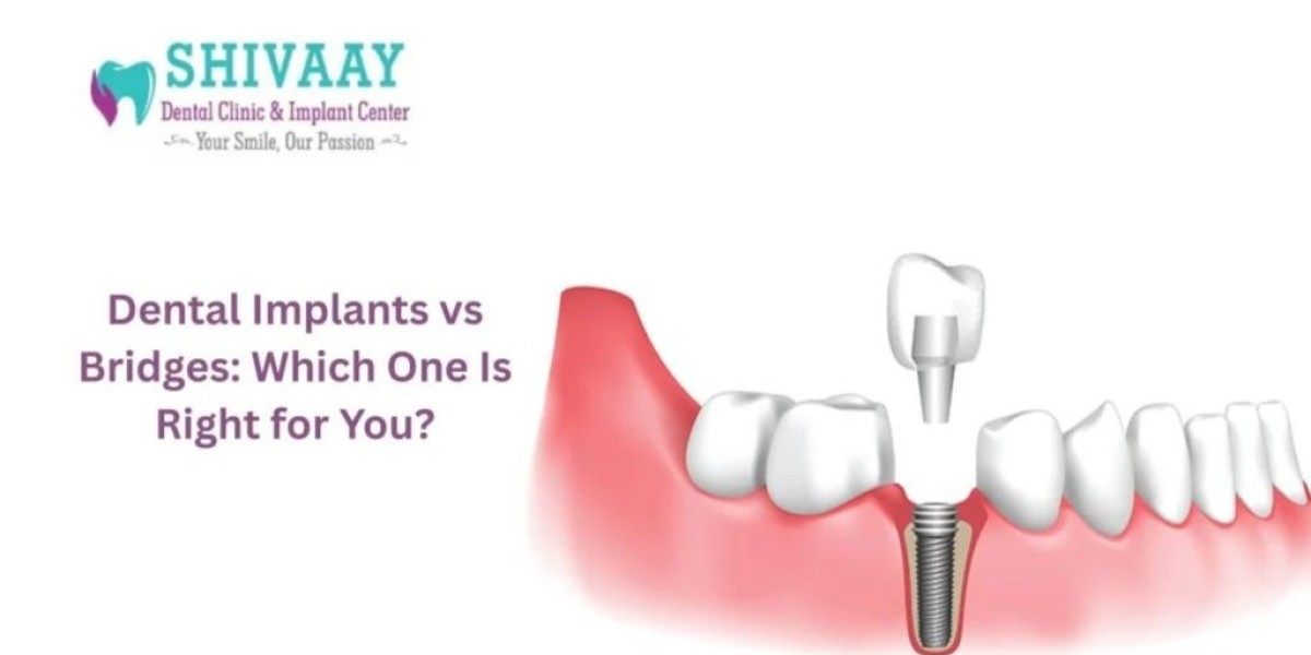 Best Dental Clinic in Indore – Your Smile, Our Passion