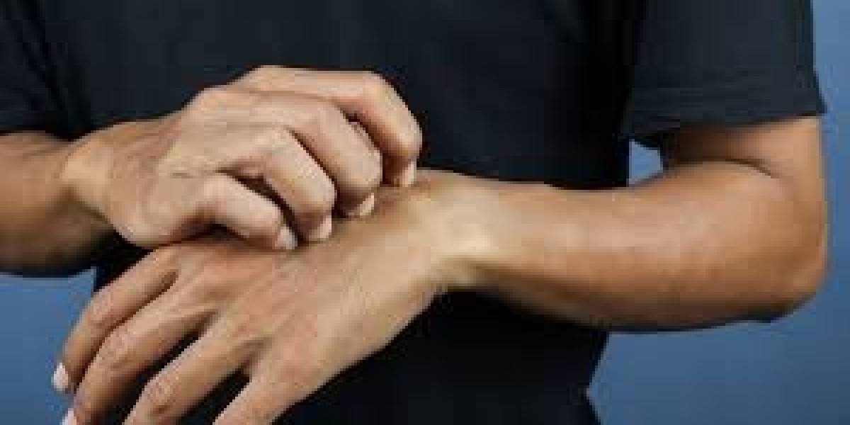Cognitive Behavioral Therapy for Skin Picking: Effective Treatment Strategies and Benefits