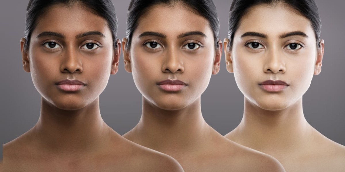 How Does Skin Type Affect Your Overall Skin Whitening Treatment Cost?