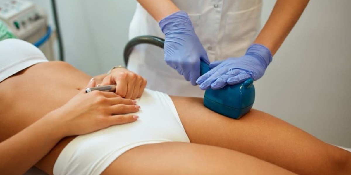 Can Radio Frequency Therapy Effectively Reduce Cellulite?