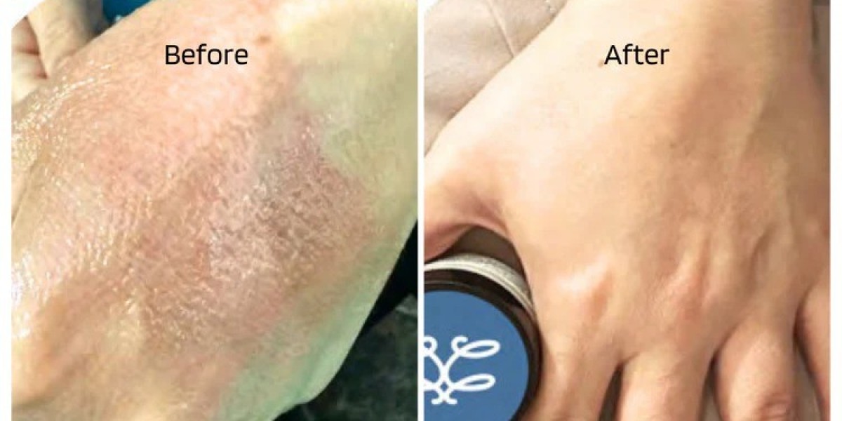 Nourish Naturally: The Best Fragrance-Free, Steroid-Free Body Cream for Dry Skin