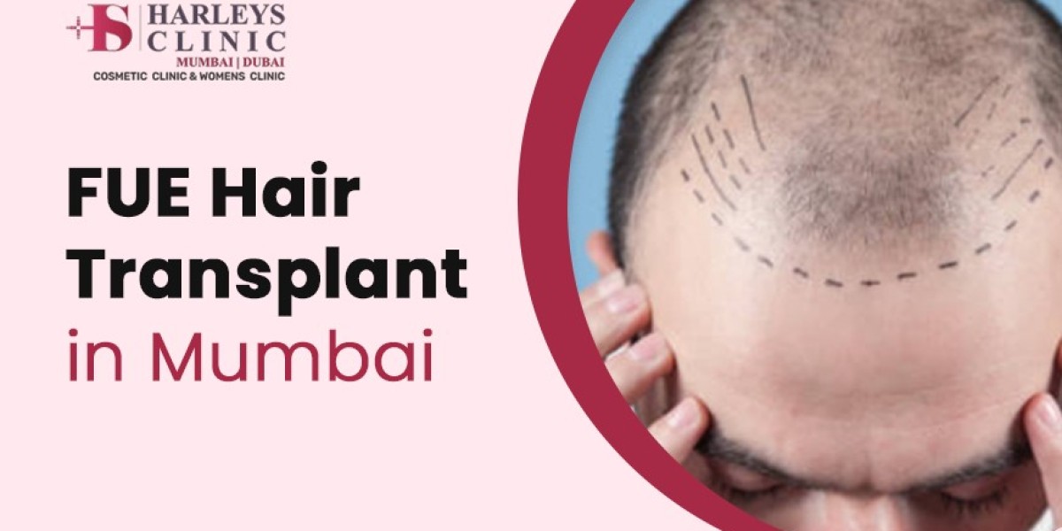 Detailed Benefits of FUE Hair Transplant