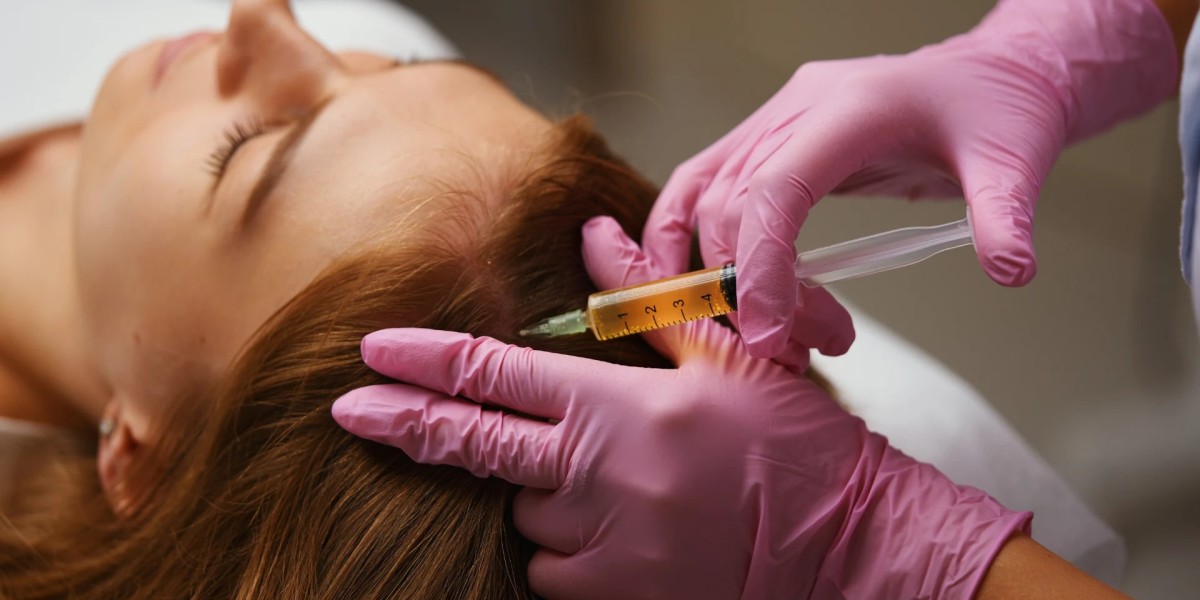 Is Stem Cell Hair Transplant Good for Receding Hairlines?