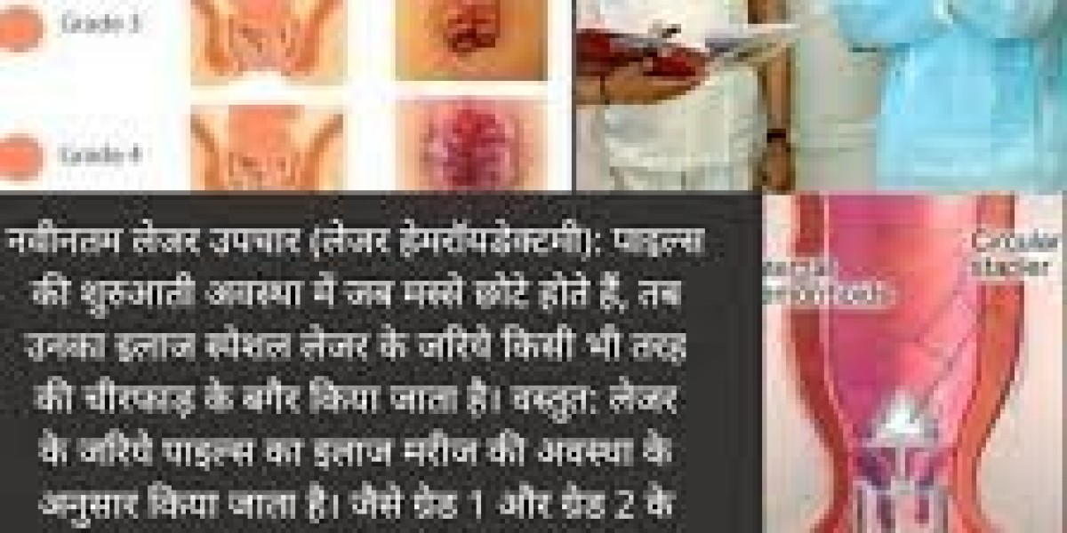 Top Piles Doctor in Indore – Dr. P. S. Lubana