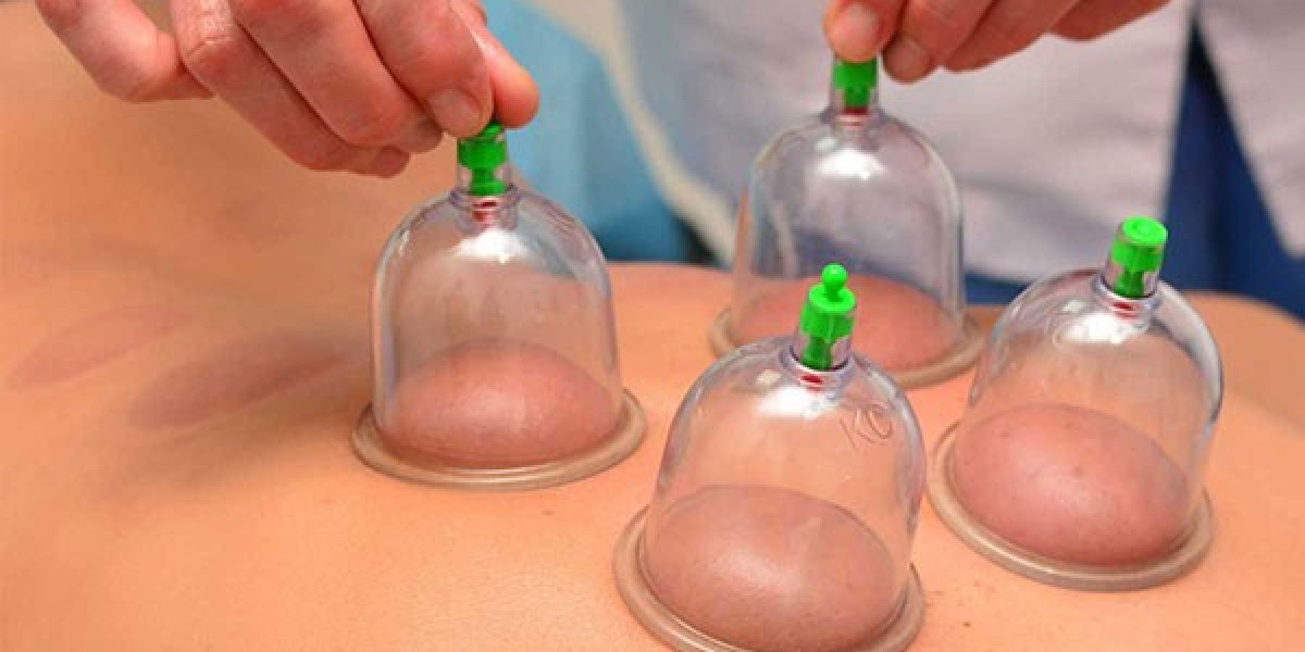 Hijama Therapy in Gurgaon – A Natural Way to Heal and Rejuvenate