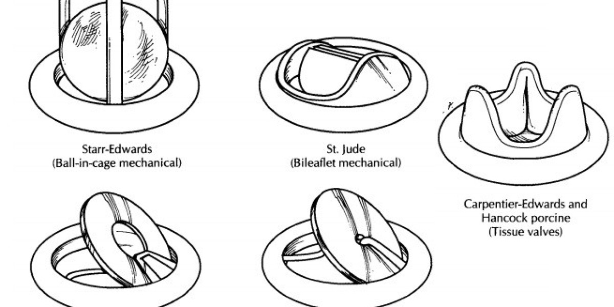 Prosthetic Heart Valves Market Boosted by Aging Population and Innovations in Bioengineered Valve Materials