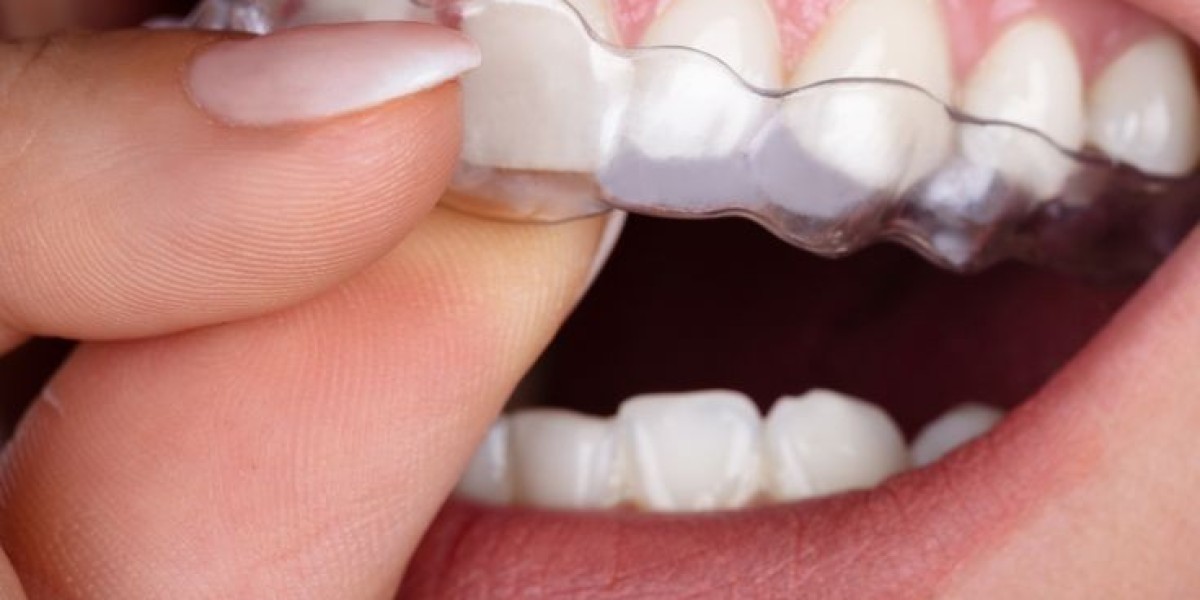 Your Guide to Modern Teeth Straightening Options in Notting Hill