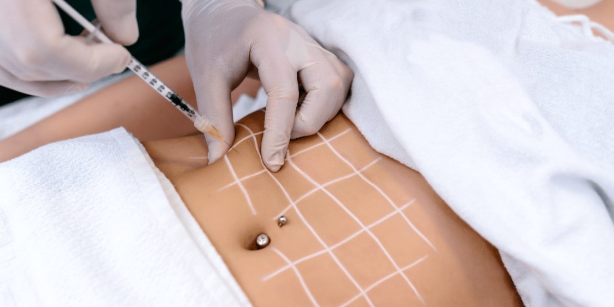 Is Lipolysis Treatment Effective for Male Chest Fat?