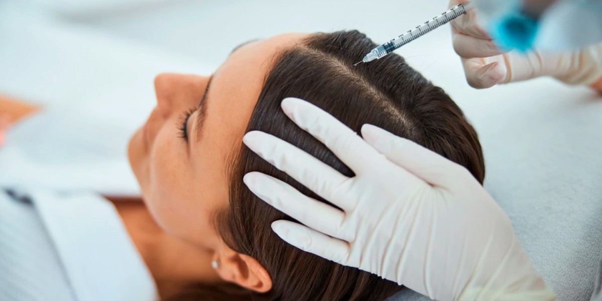 Step-by-Step Guide to PRP Hair Treatment in Islamabad