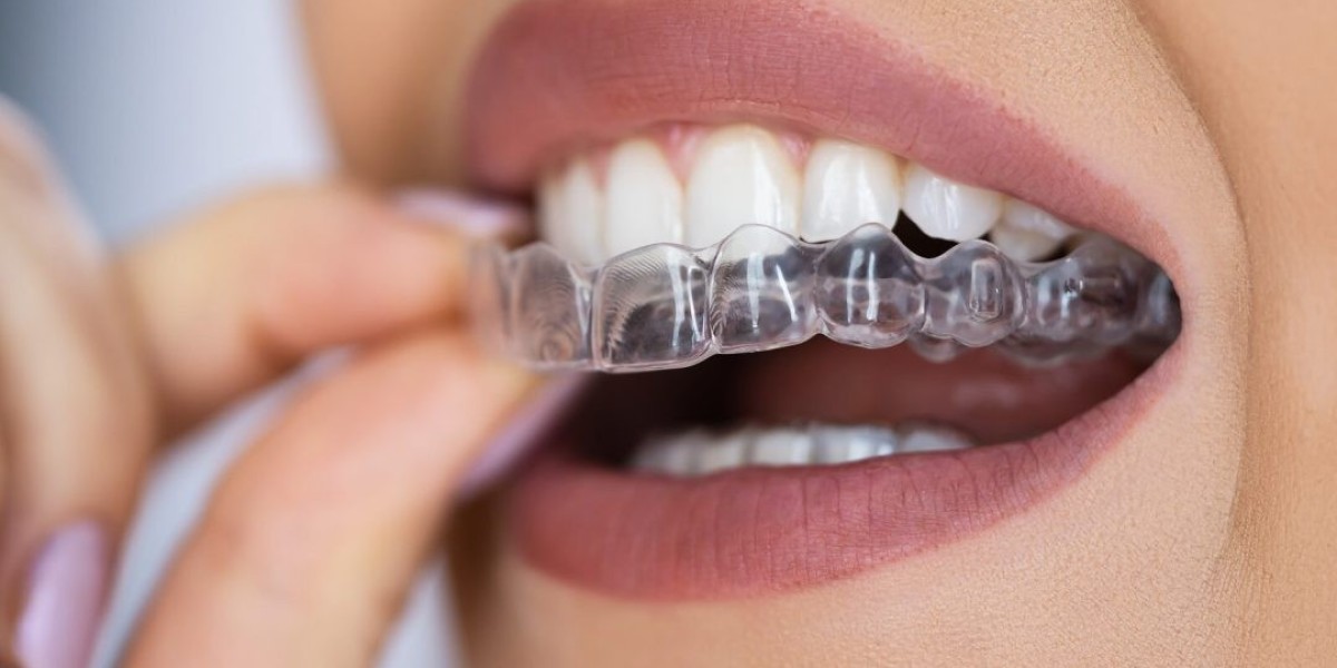Invisible Aligners Benefits, Process, Cost & Timeline