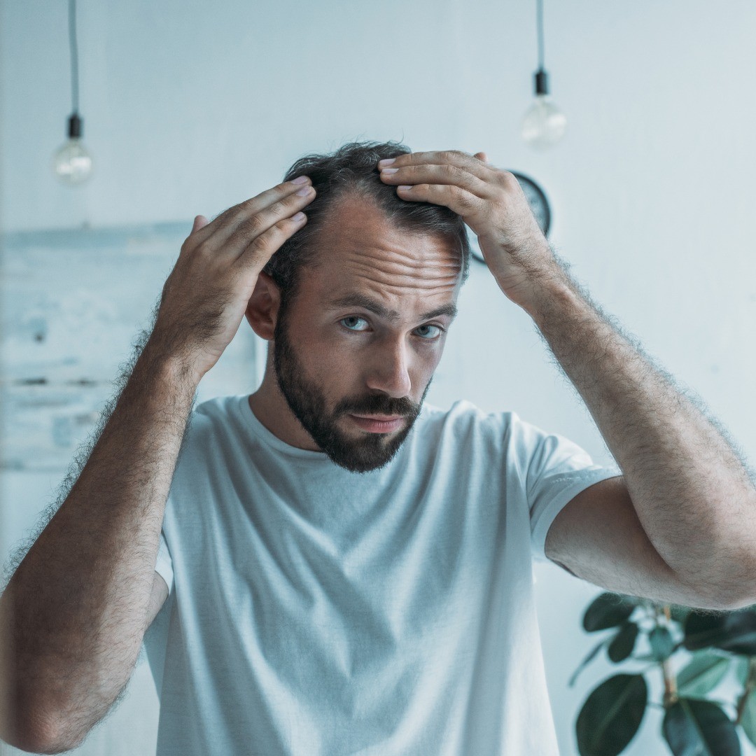 Finasteride 1mg for hair loss