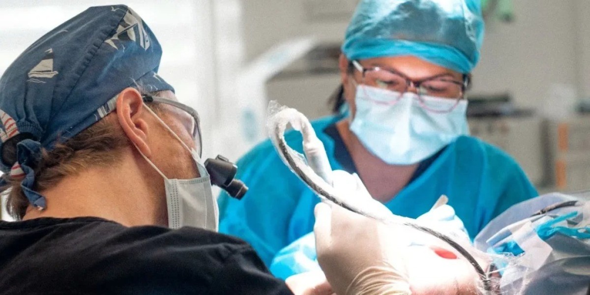 Choosing the Best Hair Transplant Clinic in London