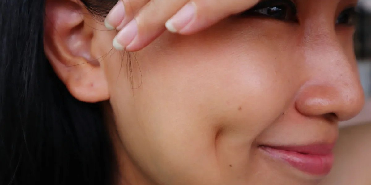 Minimally Invasive Dimple Surgery Options in Islamabad