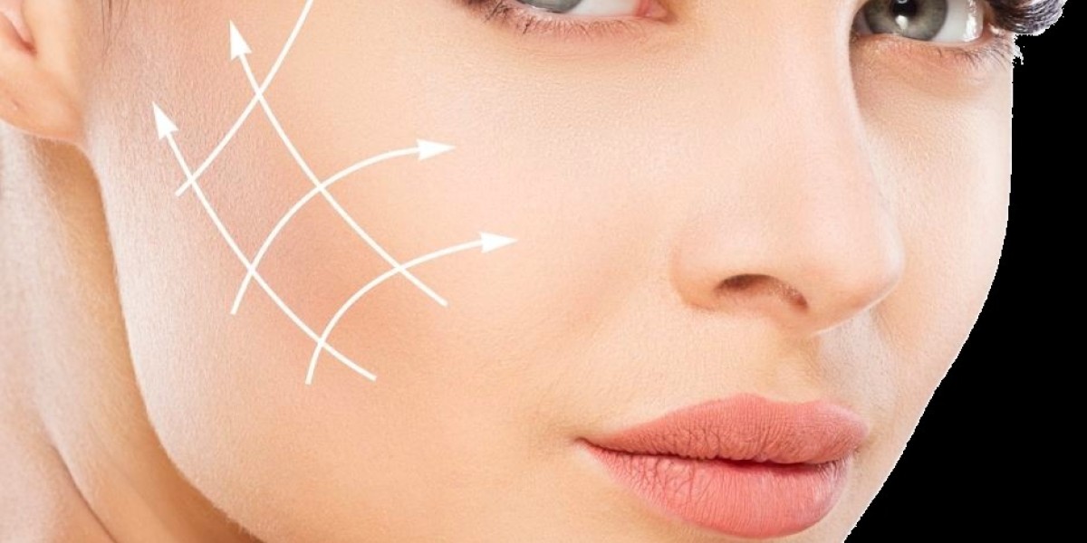 What are the Benefits of Sugar Thread Lift?