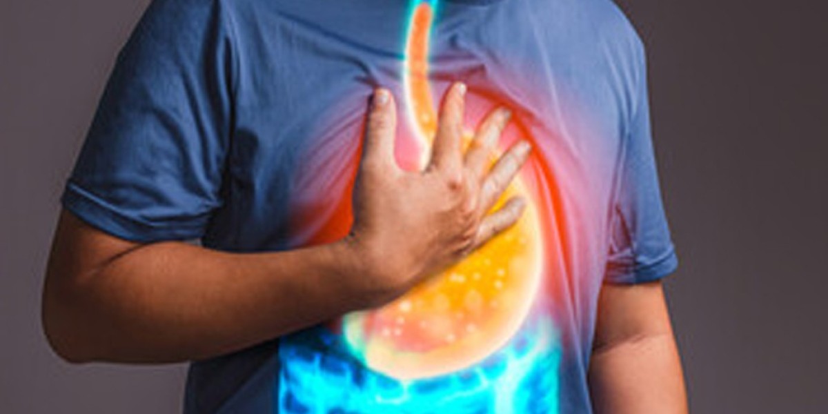 Beat Constipation, Acidity & GERD: A Complete Guide to Healthy Gut Habits