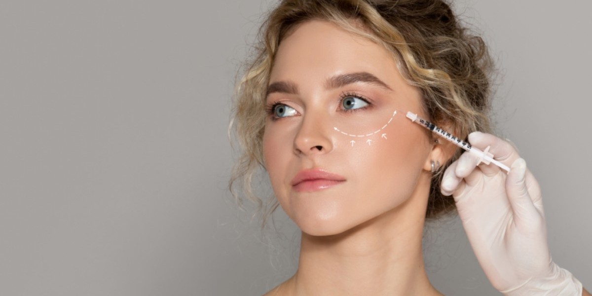 Can Sculptra Be Applied Under the Eyes Safely?